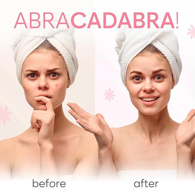 Invisible Pimple Patches for Face (324 Count), Hydrocolloid Stickers Covers Pimples, Zit Patches for Spot Cover, Clear (2 Sizes - S/L)