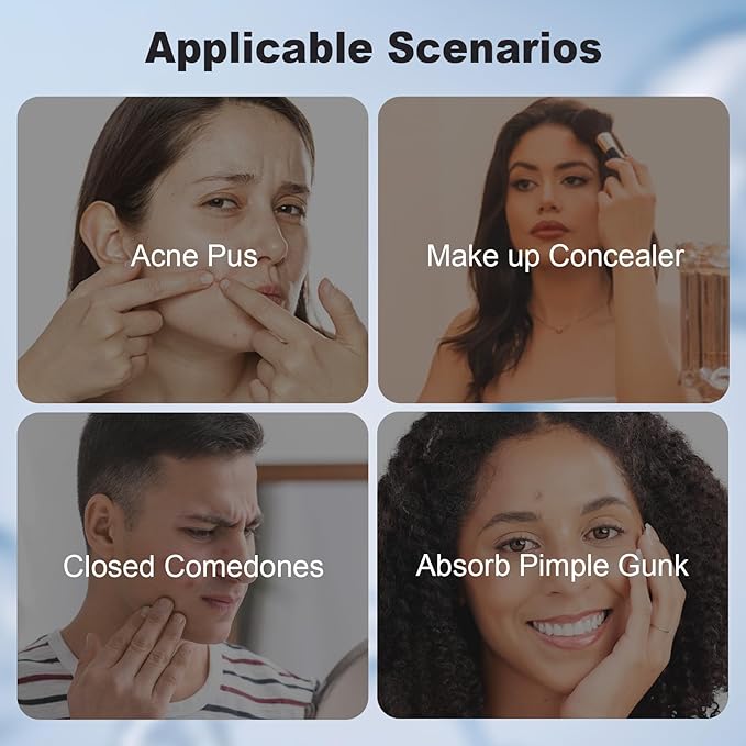 Pimple Patches for Face, Hydrocolloid Pimple Acne Patch for Covering Zits and Blemishes, Spot Stickers for Facial Skin Care (48 Count)