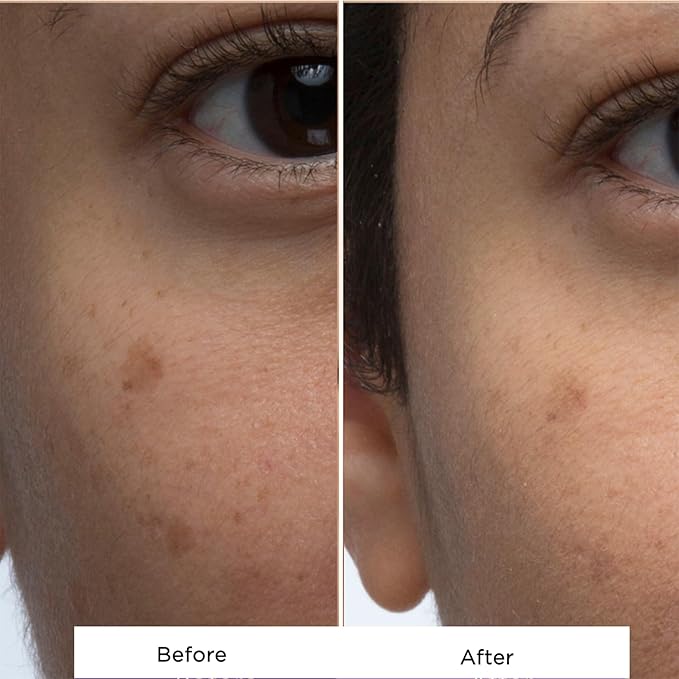 Hey Honey Skincare Propolis Facial Cleanser Foam Formula that Replenishes Skin Barrier | Gentle Face Wash for Oily, Acne-Prone & Sensitive Skin | Natural Ingredients, Non-Comedogenic | 5 oz