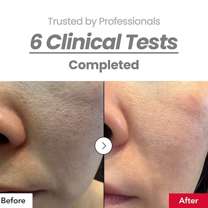 Pore 55% Skin Texure Pad – AHA BHA LHA, Retinol & Rice Extract for Enlarged Pores, Textured Skin, Sebum Control, Exfoliating Toner Pads for Glass Skin, Non-Irritating, Korean Skincare(60ct)