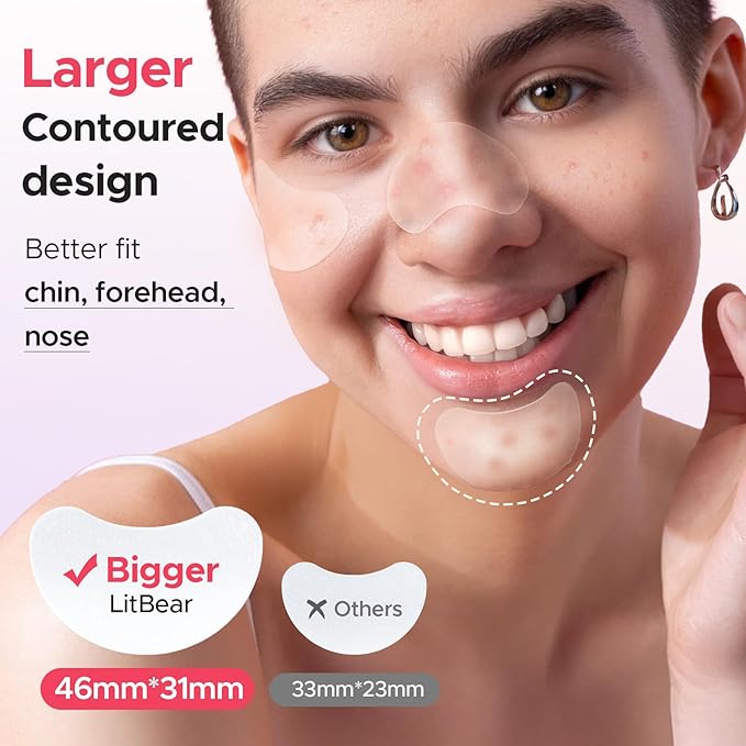 LitBear Large Pimple Patches, 5 Size 416 Count Big Acne Patches for Face, Chin, Forehead and Body, Zit Patches for Dots, Blemishes and Large Breakouts, Hydrocolloid Patch (XL Strip, Contoured, Round)