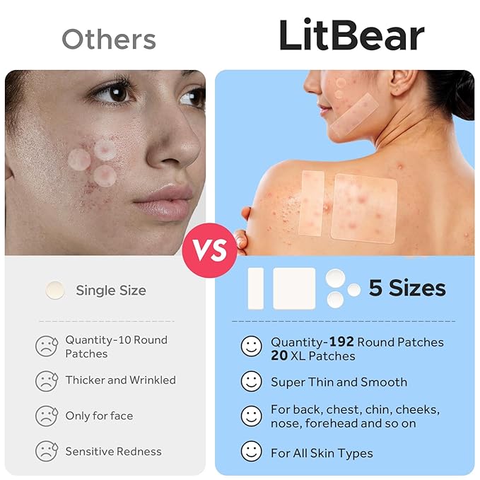 LitBear Large Pimple Patches, 5 Sizes 212 Counts Big Acne Patches for Face, Forehead, Body and Back, Hydrocolloid Bandages for Zits, Blemishes and Large Breakouts, Hydrocolloid Patch Pimple Stickers