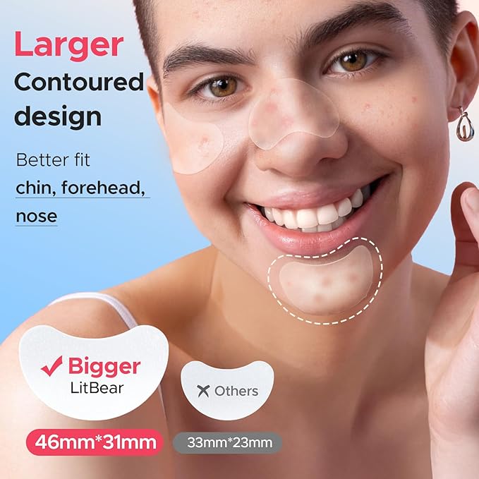 LitBear Large Pimple Patches, 5 Size 224 Count Big Acne Patches for Face, Chin, Forehead and Body, Zit Patches for Dots, Blemishes and Large Breakouts, Hydrocolloid Patch (XL Strip, Contoured, Round)