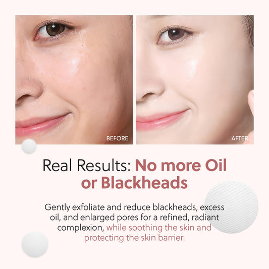 Rxcue Glow Mini Trio Skin Care Set: Mini Skincare Travel Kit for Women, 10-to-3 Step Korean Skin Care Routine Kit for Glass Skin, Travel Size Skincare, Face Care Kits & Beauty Gift Sets 1.01 fl oz