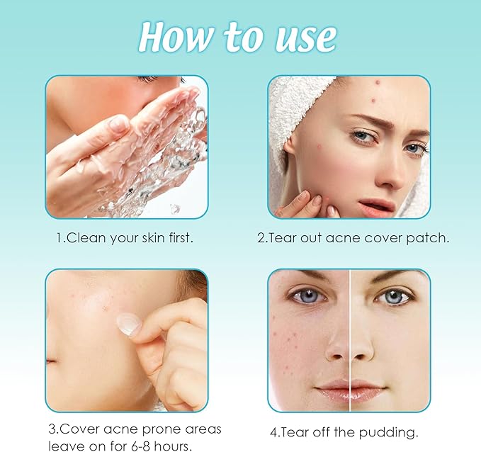 Large Pimple Patches Acne Patches hydrocolloid Bandages for Face Forehead Chin Body Chest Back Blemish Patch with Multiple Sizes (134pcs)