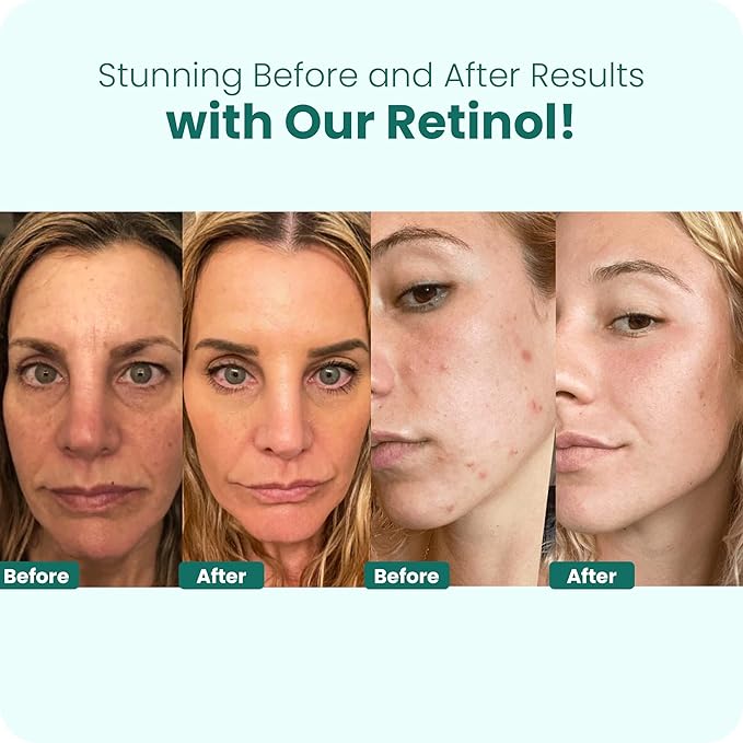 Gin Amber Beauty - Pack of 4 Serums (1 fl oz - 30 ml)