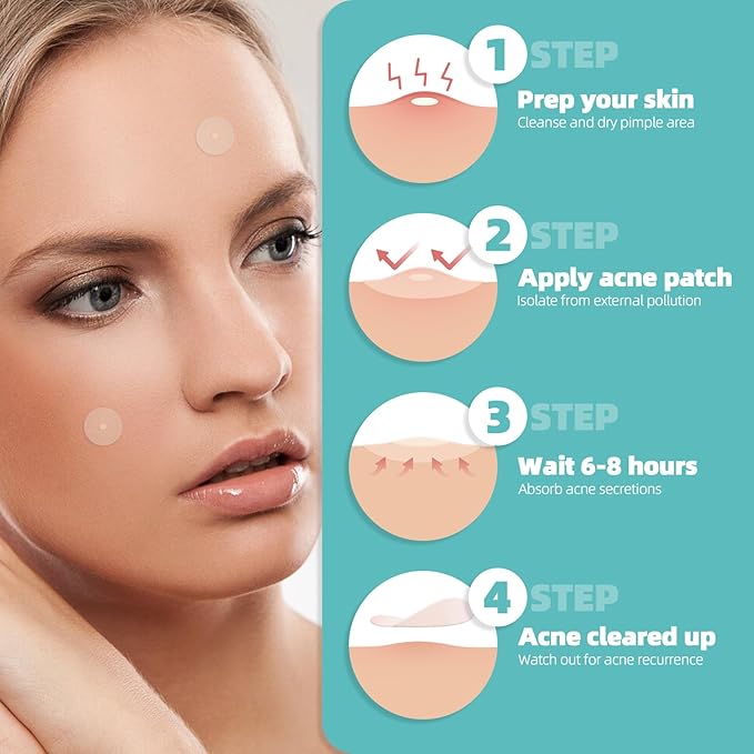 New Pimple Patches for Face, 3 Different Sizes Hydrocolloid Acne Patches, Pimple Patch Pimple Stickers for Covering Zits and Blemishes, Zit Patches Sticker for Face and Skin (X35 X2 X3)