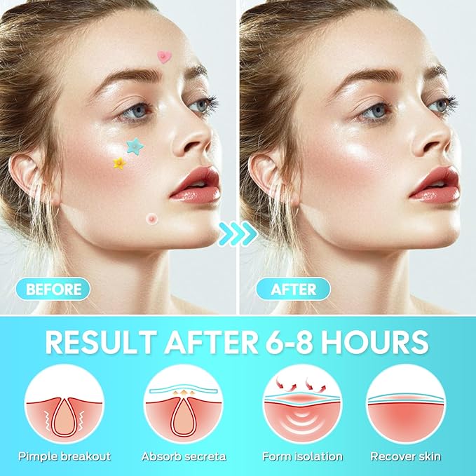 Zit Patches,Hydrocolloid Star Pimple Patches for Face,Acne Patches for Face,Invisible Blemish Patches with Tea Tree, Salicylic Acid and Centella Asiatica 306 Count,Vegan,Suitable for All Skin Types