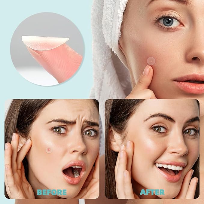 New Pimple Patches for Face, 3 Different Sizes Hydrocolloid Acne Patches, Pimple Patch Pimple Stickers for Covering Zits and Blemishes, Zit Patches Sticker for Face and Skin (X35 X2 X3)