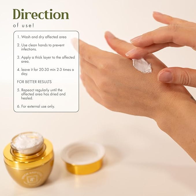 Skin Soothing Antiseptic Cream for Burns, Cuts, Blisters & Rashes, Restorative Wound Healing Balm with Aloe Vera, Beeswax & Olive Oil, Fast Relief Antiseptic Ointment Safe for All Skin Types, 50g Jar