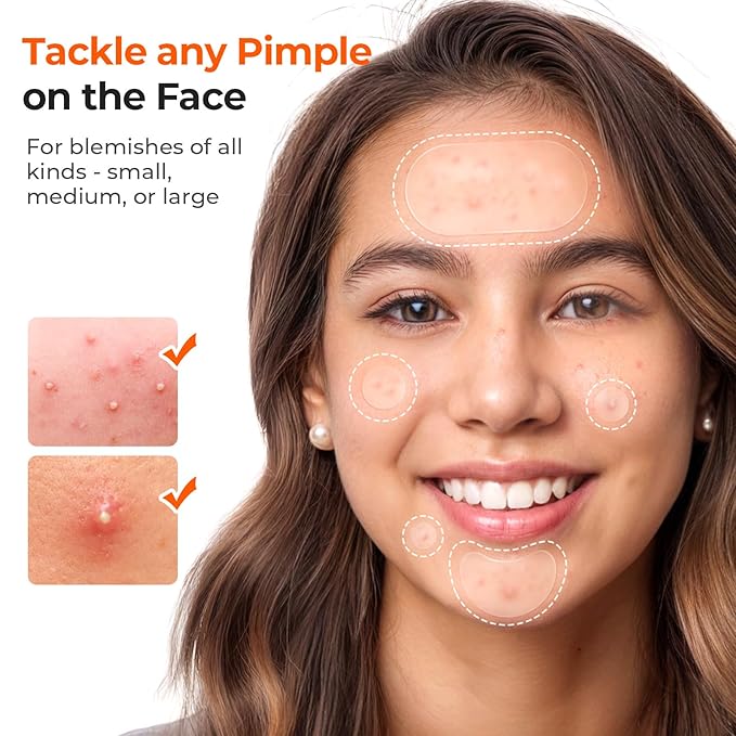 TKTK 609 Count Pimple Patches for Face, Hydrocolloid Acne Patch Bulk, Acne Stickers for Covering Cheeks, Forehead, Chin Blemishes Zit Breakouts for All Skin Types (Dots, Strip, Contoured 5 Sizes)