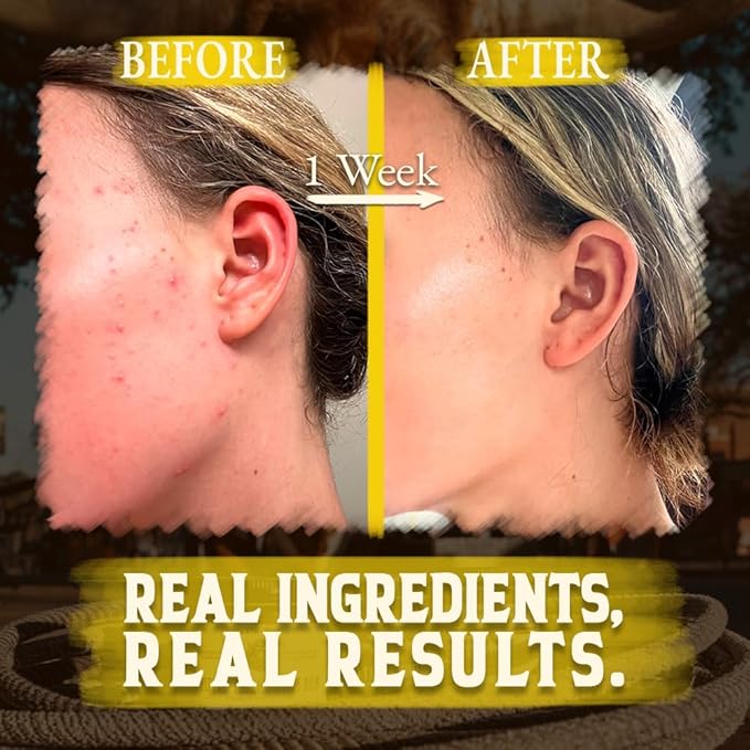 Wrath & Remedy Handmade Whipped Organic Beef Tallow for Skin - 4 OZ (Citrus) — Grass Fed Beef Tallow Moisturizer and Honey Balm for Silky, Sensitive-Skin, Eczema, Rosacea - Free of Harsh Chemicals