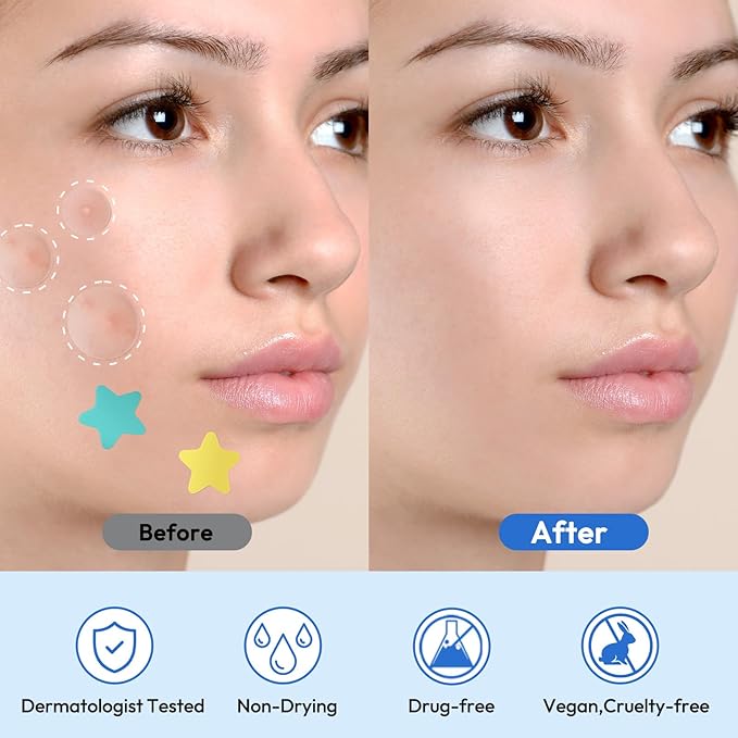 Pimple Patches for Face 335 Patches-255 Round & 80 Star Cute Coloful Acne Patches,Hydrocolloid Pimple Patch Colorful Spot Stickers w/Tea Tree, Salicylic Acid & Cica Oil| Classic & Fashion Zit Covers
