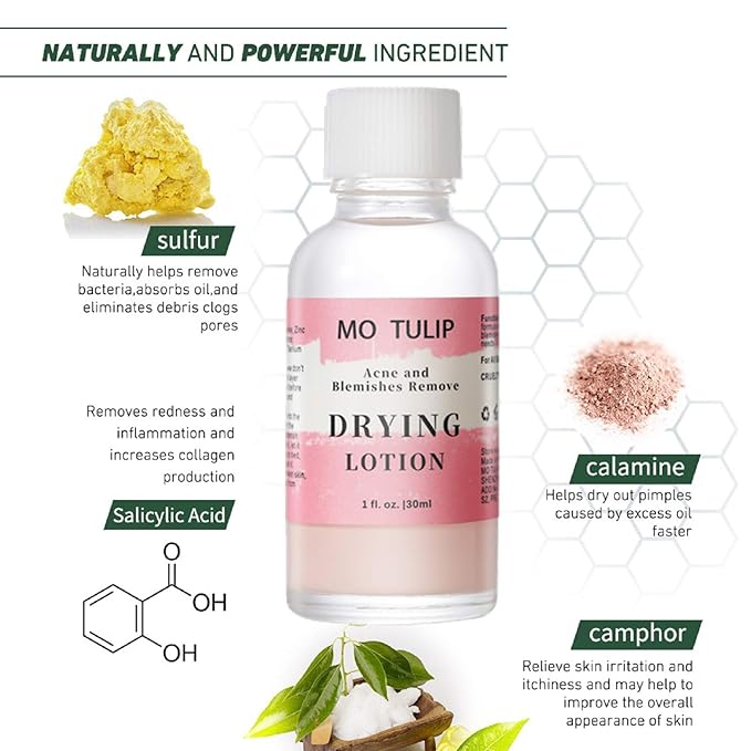 MO TULIP Acne Drying Lotion, Overnight Acne Acid and Acne Spot Treatment for Face and Body, Pimple Lotion Spot Treatment, Dry Out Pimples, Blemishes, and Clean pores (1OZ)