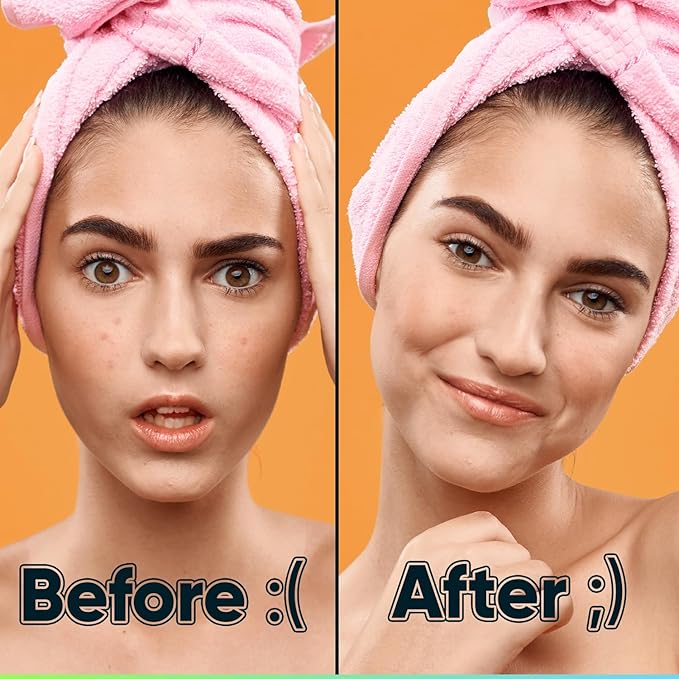 Pimple Patches for Face with Tea Tree Oil 216 pcs. Hydrocolloid Acne Pimple Patches. Blemish Patches, Acne Dots, Pimple Stickers, Acne Patch and Pimple Patch