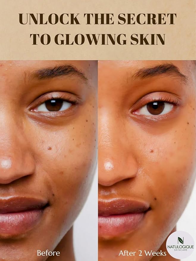 Premium Hyaluronic Acid Serum for Skin 100% Pure and Organic – Anti-Aging Face Moisturizer for Fine Lines & Wrinkles – Fragrance-Free, Vegan, Natural Skincare – 1oz (30ml) by Natulogique