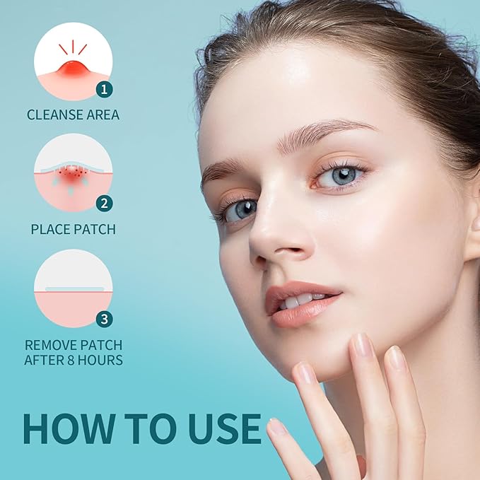 Microdart Acne Patch - Hydrocolloid Blemish Treatment | Salicylic Acid & CICA | Clinically Proven | Deep,Early-Stage Pimples | Sensitive Skin & Non-Irritating | Vegan & Cruelty-Free | 9 patches