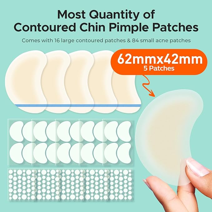 TKTK Chin Pimple Patches (235 Count 6 Sizes), XL Contoured Hydrocolloid Chin Patch 62x42 mm, Large Acne Patch for Face Blemishes Zit Breakouts, Maximum Absorption Overnight Stickers