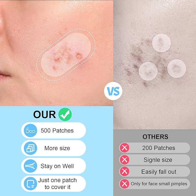 AUSLKA Large Pimple Patches for Face (5 Sizes 500 Patches), XL Hydrocolloid Pimple Patch, Big Hydrocolloid Zit Spot Patches for Breakouts, Body, Cheek, Forehead, Chin and Back