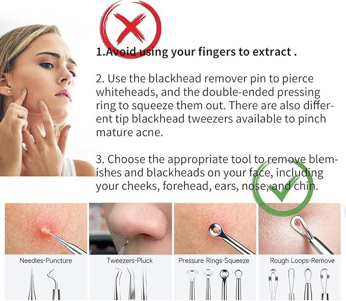 2025 Professional Pimple Popper Tool Kit - 22 PCS Blackhead Remover Tools for Acne and Zit Popping Comedone Extractor with Magnifying Glass