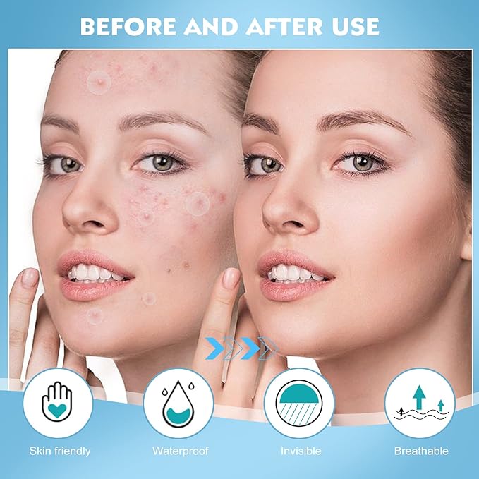 Pimple Patches for Face - 108 Hydrocolloid Acne Pimple Patches Salicylic Acid with Tea Tree Oil for Zit Blemish Spot Covers Invisible Pimple Stickers Not Tested on Animals