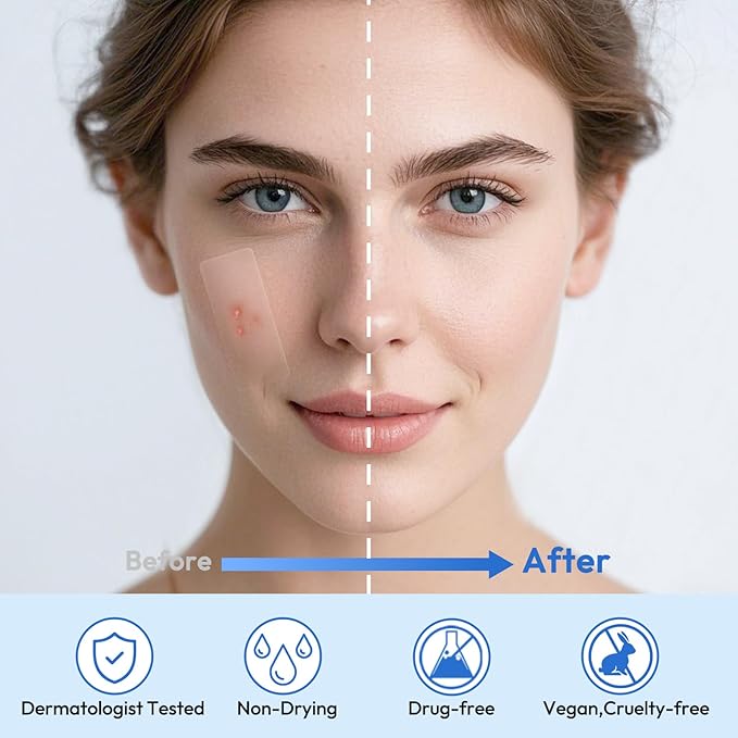 Large Pimple Patches Full Face,484 Patches,XL Acne Patches,Big Hydrocolloid Bandages for Body, Forehead, Chin, Neck Zit Breakouts w/Tea Tree, Salicylic Acid & Cica Oil|,Freely Customized Pimple Patch