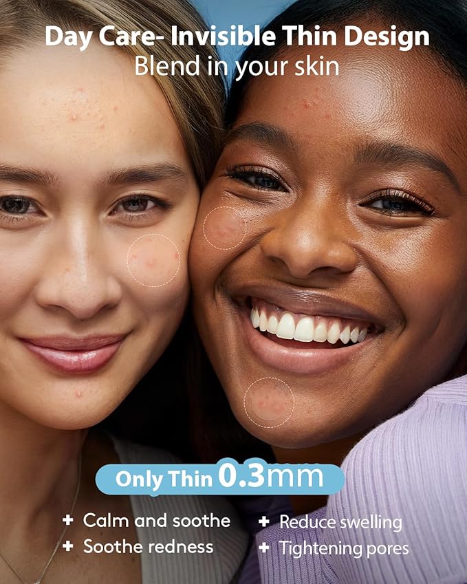 LitBear Acne Pimple Patches- Day and Night 4 Sizes 588 Dots Thin & Thick Hydrocolloid Patches with Witch Hazel, Tea Tree & Calendula Oil, Extra Adhesion for Face Zit Patch Dots