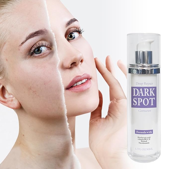 Dark Spot Remover for Face and Body, Dark Spot Corrector for Age Spots & Brown Spots, Rapid Tone Repair Cream with Advanced Formula with Hyaluronic Acid & Vitamin C Treatment (1.7 Fl Oz)