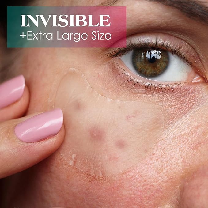 AUSLKA Pimple Patches for Face,Large Hydrocolloid Patches, Zit & Blemish, Large Spot Stickers for Chin, Cheeks, Body with Tea Tree & Calendula Oil, 18 Count