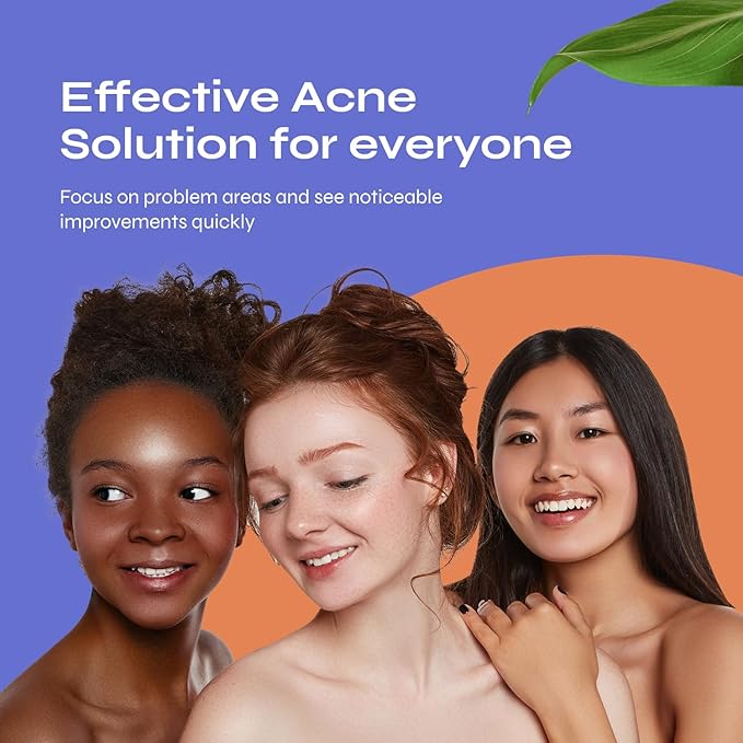 Bio Clean Drying Lotion Best for Treating Pimples Best for Oily Skin Prevents Dryness and Flakiness Pimple Lotion Spot Treatment .68 fl. oz. 20 ml