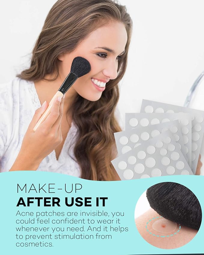 Pimple Patch Acne Patch, 4 Sizes 280 Patches Acne Absorbing Cover Patch, Hydrocolloid Invisible Acne Patches For Face Zit Patch Acne Dots Tea Tree, Calendula Oil - 2 Pack