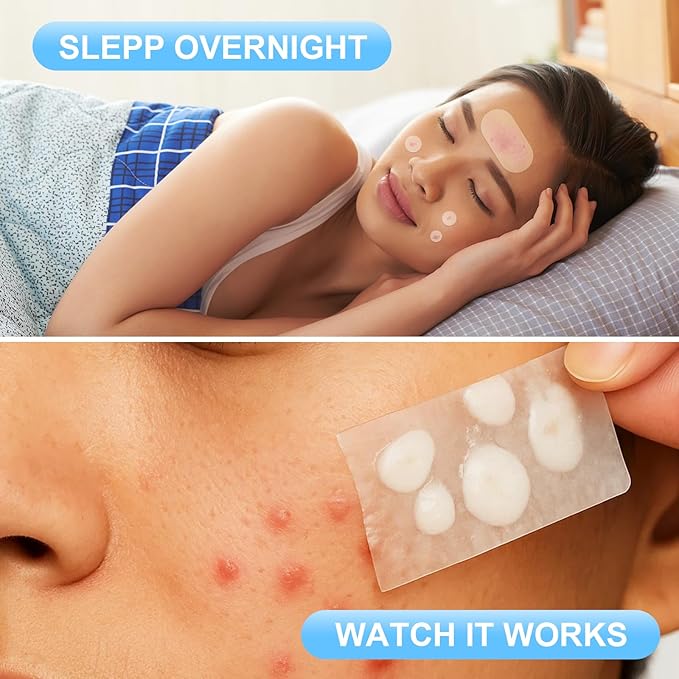 AUSLKA Large Pimple Patches for Face (5 Sizes 500 Patches), XL Hydrocolloid Pimple Patch, Big Hydrocolloid Zit Spot Patches for Breakouts, Body, Cheek, Forehead, Chin and Back