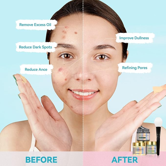 KAISASA 3PCS Clay Face Mask Skincare - Facial Skin Care Mask for Deep Pore Cleansing Turmeric Dead Sea Mud Green Tea Purifying and Hydrating - Reduce Acne Blackheads for Women and Men 2.5 OZ each