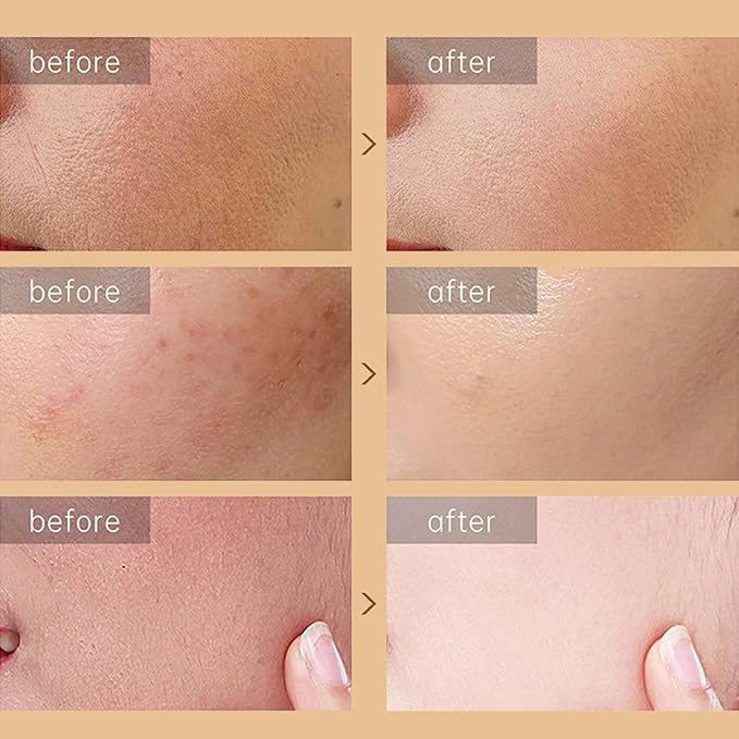 Snail Repair Cream, Snail Moisturizer with Snail Secretion Filtrate, Repair Damage Skin, Ruduce Fine Line, Hydration Snail Face Cream for Dry Skin, Snail Mucin Essence for Women Skin Care