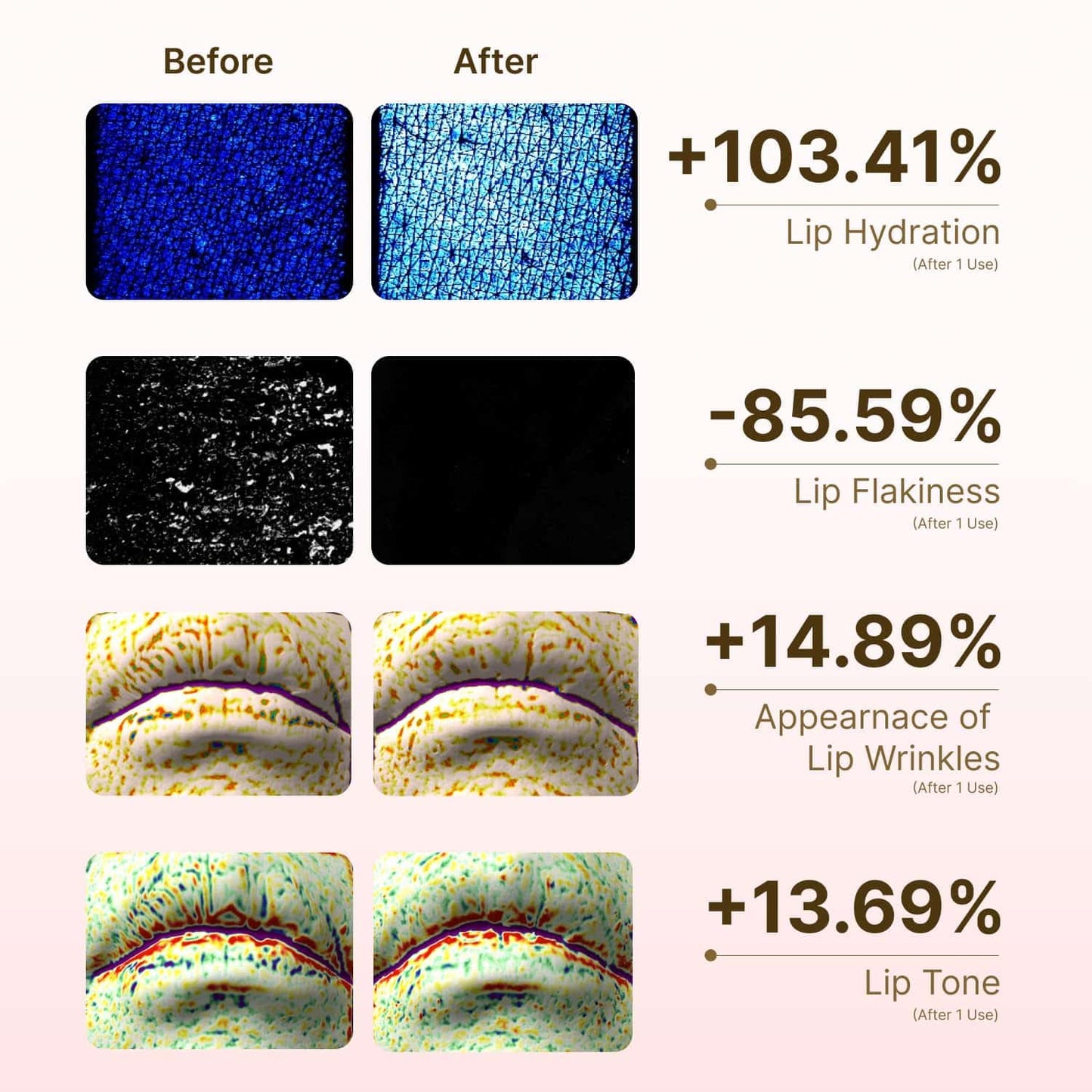 beenuvo Honey & Collagen Lip Butter, Hydrating Lip Treatment, Overnight Lip Mask, Moisturizing Lip Balm with Jojoba Oil & Squalane, Lip Care, Korean Skin Care (0.45 oz)