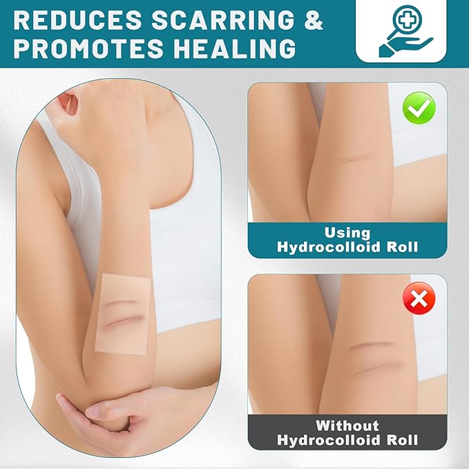 WUYUAN Hydrocolloid Roll for Wound Care, 4in*6.6ft Hydrocolloid Bandages with Self-Adhesive, Extra Large Hydrocolloid Patch Bandages Cut-to-Size, Ultra Absorbent, Waterproof