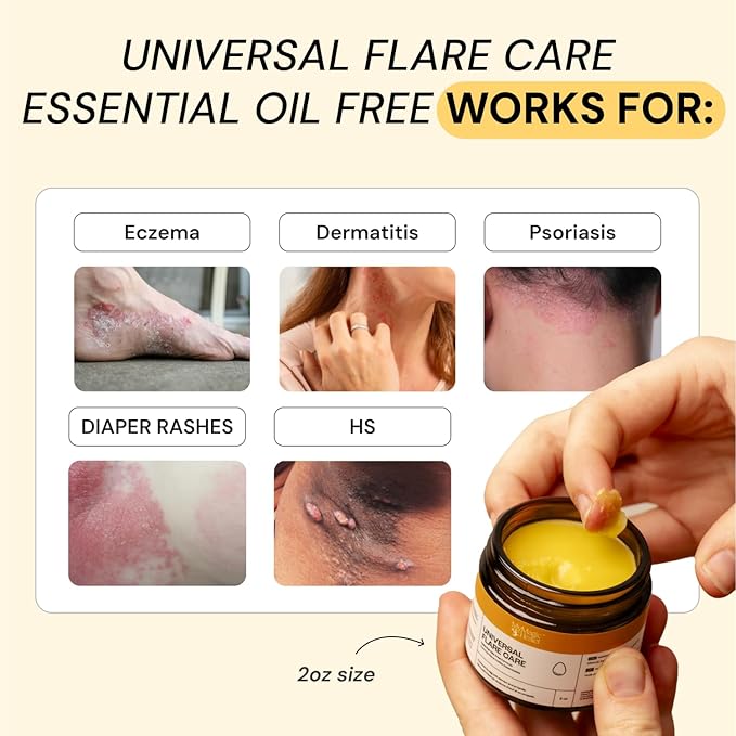 Universal Flare Care | Essential Oil Free | Relief for Rashes, Eczema, Psoriasis, Hidradenitis Suppurativa, Impetigo, Dermatitis, Wound Care, Sensitive Skin w/ Propolis & Egg Yolk 2 oz