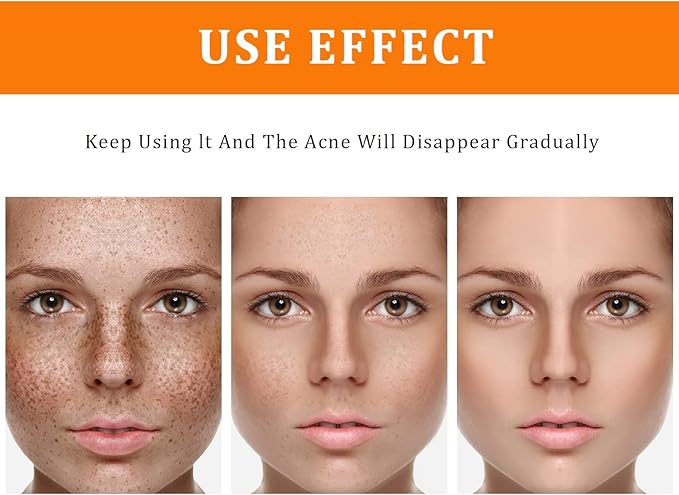 Toner for Dark Spots Turmeric Dark Spot Corrector Toner, Facial Toner for Acne Prone Skin, Dark Spot Remover for Face Hydrating Face Toner for Women, Moisturizing Toner Face for Dry Oily Skin- 4OZ