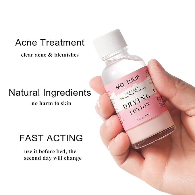 MO TULIP Acne Drying Lotion, Overnight Acne Acid and Acne Spot Treatment for Face and Body, Pimple Lotion Spot Treatment, Dry Out Pimples, Blemishes, and Clean pores (1OZ)