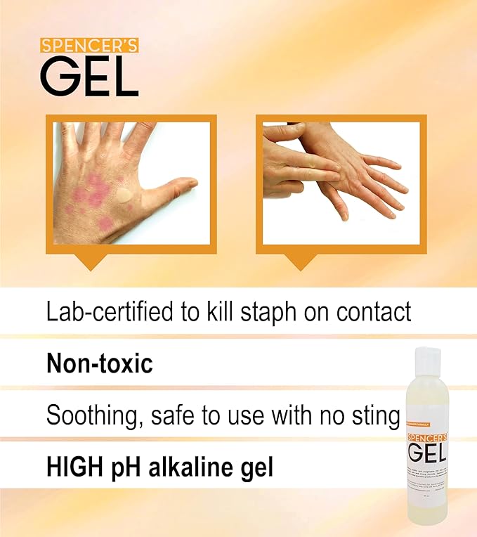 Spencer's Gel Alkaline Formula (4 oz) Since 2004 The Only High-pH Solution for Stubborn Skin Issues (Boils, Furuncles, Ulcerations, Pressure Wounds, etc.) Non-Stinging, Fast-Acting