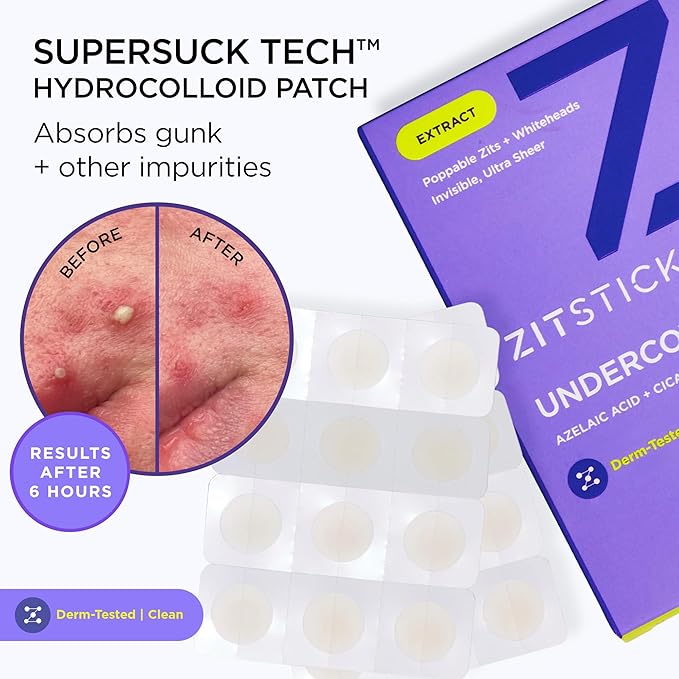 ZitSticka Invisible Pimple Patches for Face, Hydrocolloid Patches, Ultra-Thin Clear with Azelaic Acid & CICA Blemish Patch, Pimple Stickers (UNDERCOVER 108ct)