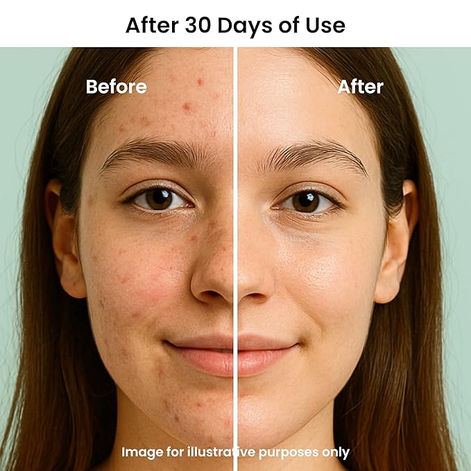 Feat By You ViTassie Forest Energy Vitamin Ampoule Solution - (2.70 fl.oz) Korean Skin Care Serum with Vitamin C, Niacinamide, Hyaluronic Acid, Fast Absorbing, Non-Greasy, Hydrating