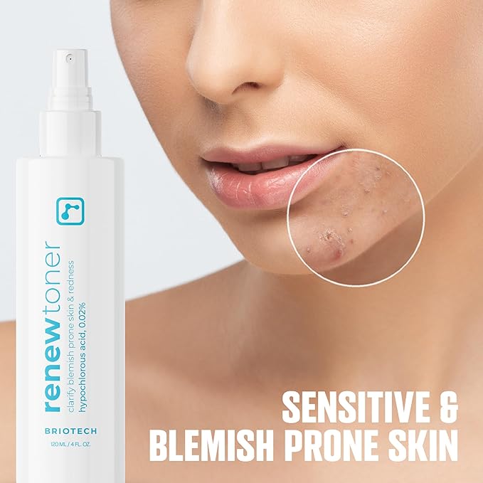 BRIOTECH Renew Toner, Hypochlorous Acid Spray, Minimize Appearance of Blemishes, Soothing Facial Mist for Sensitive Skin, Calm Redness & Bumps, Hypoallergenic & Vegan, 2 fl oz Travel Size