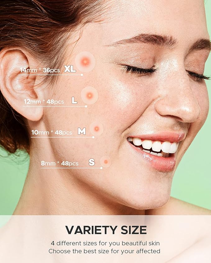 Acne Pimple Patch (180 Counts 4 Sizes), FSA Eligible Invisible Hydrocolloid Acne Patch with Tea Tree Oil & Calendula Oil, Acne Spot Patch Zit Patches for Face