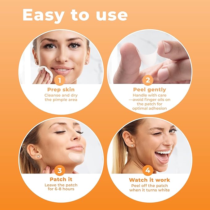 Chin Pimple Patches (12 Pack), Remove Chin Acne Overnight with Large Hydrocolloid Acne Patches For Blemishes on Chin, Cheek, Forehead