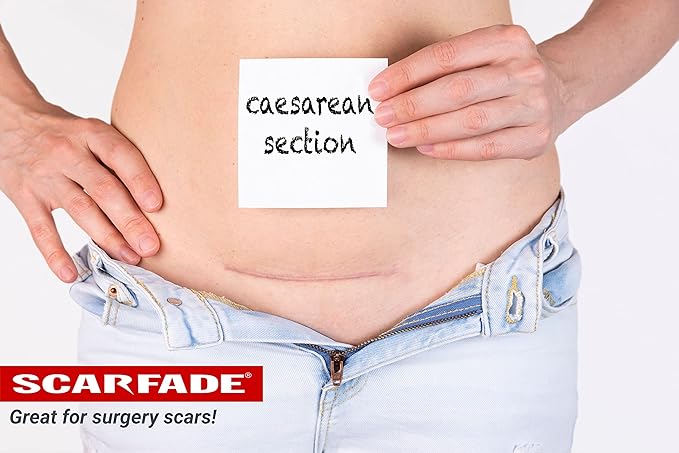 Elite Advanced Scar Treatment, Scar Removal, Scar Therapy, Scar Prevention, Anti Scar Gel with Silicone & Vitamin C -15g