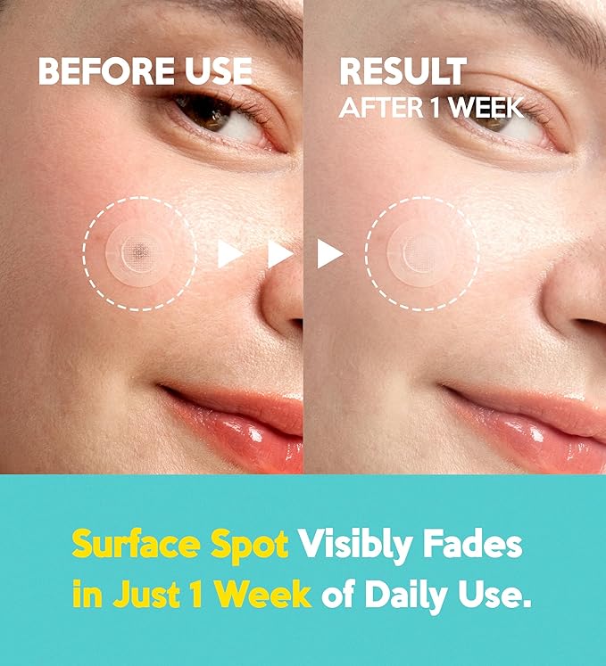 Troubless Micro Patch Plus Vitamin C - Zit Hydrocolloid Patch for Stubborn Marks with 10% Vitamin C - Micro-Dissolving Pyramids for High-Absorption, Seamless Adhesion & Easy-Wear (9 EA)