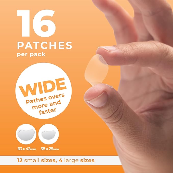 Chin Pimple Patches (12 Pack), Remove Chin Acne Overnight with Large Hydrocolloid Acne Patches For Blemishes on Chin, Cheek, Forehead