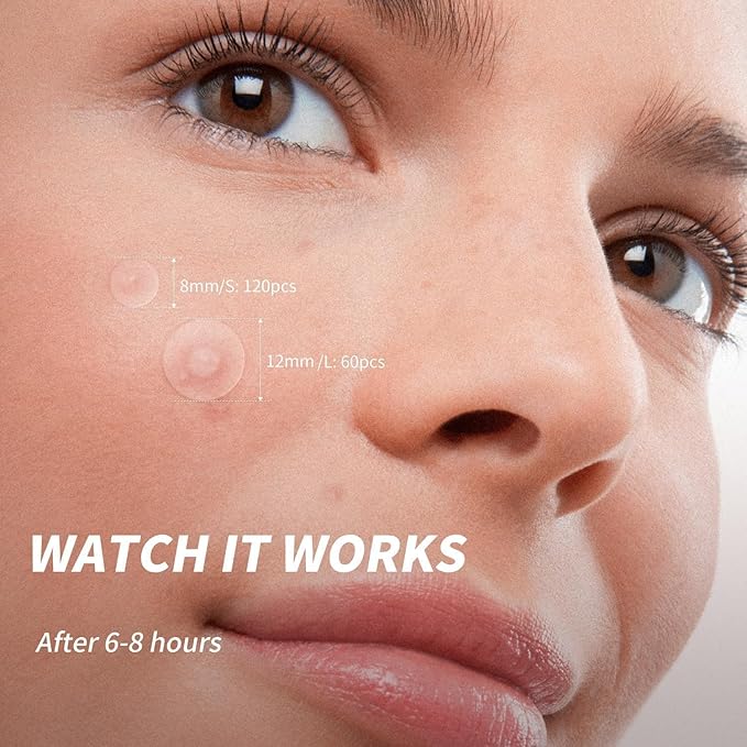 180 Counts Original Pimple Patches for Face, Hydrocolloid Acne Pimple Patch with Tea Tree Oil for Party Gift Covering Zits Blemishes