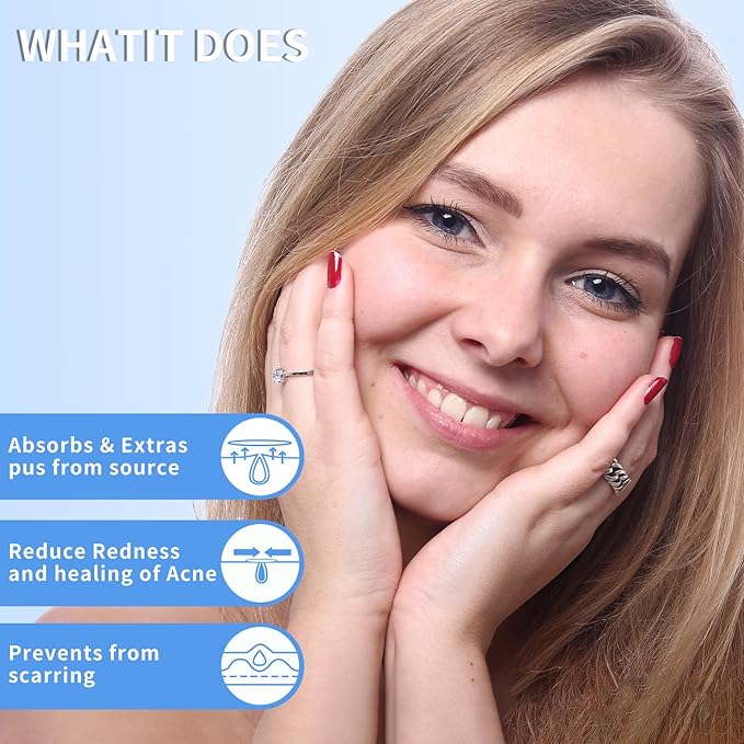 288 Counts Pimple Patches for Face, Hydrocolloid Acne Patches for Covering Zits and Blemishes, 2 Sizes of Ultra-Thin Spot Patch for All Skin Types